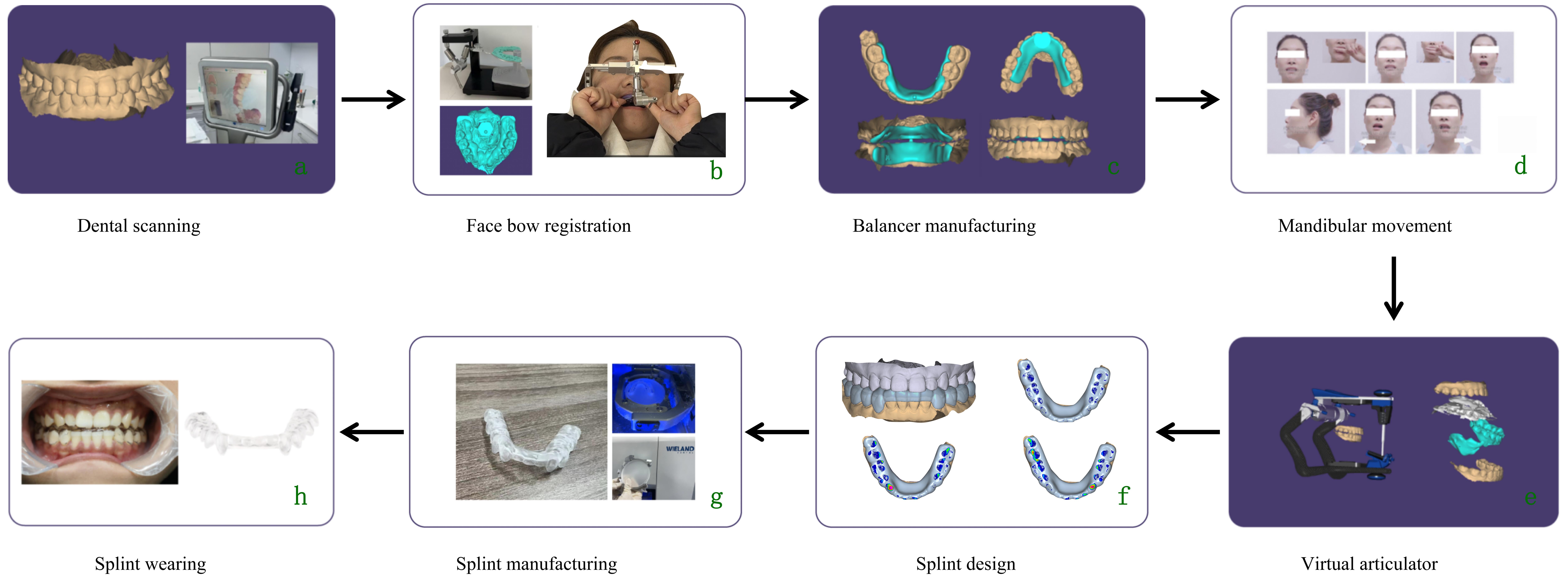 Flowchart of Kovacs Digital Occlusal Splint (KDOS) Treatment. 
(a) Dental scanning was performed using iTero. (b) Facebow registration was 
completed to capture the spatial relationship of the maxilla. (c) A digital 
balancer was fabricated based on the scanned data. (d) Guided mandibular 
movements were performed using the balancer to identify an optimal jaw position. 
(e) The final mandibular position was recorded using bite registration silicone 
and imported into Exocad software. (f) The occlusal splint was digitally designed 
with even posterior contact and canine guidance. (g) The splint was manufactured 
using a SELECT five-axis engraving machine. (h) Patients were instructed to wear 
the splint for at least 12 hours per day.
