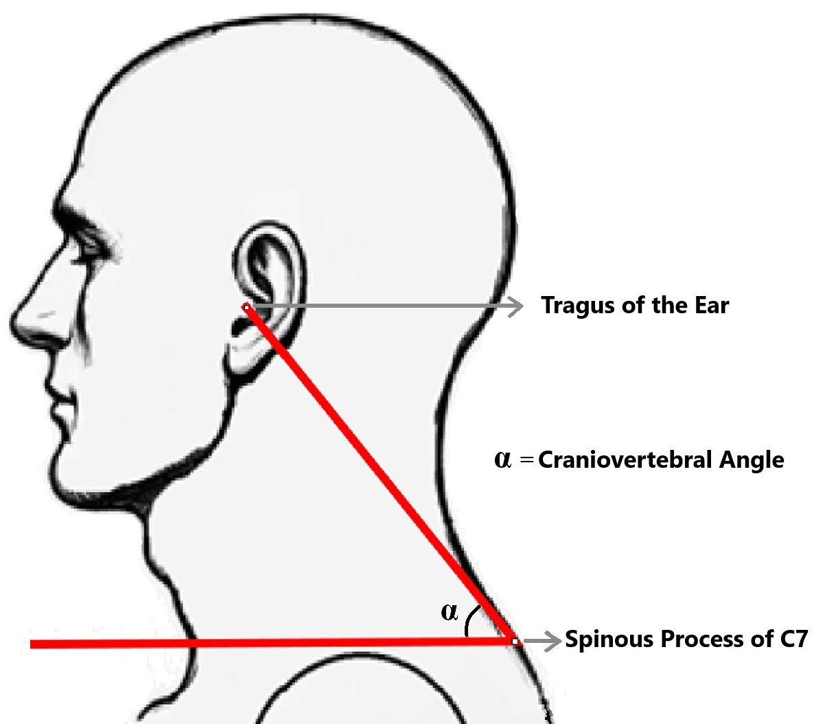 The measurement of craniovertebral angle (α) defined as
the angle formed between a horizontal line drawn parallel to the ground at the
level of the spinous process of the seventh cervical vertebra (C7) and an oblique
line extending from the tragus of the ear to the spinous process of C7.