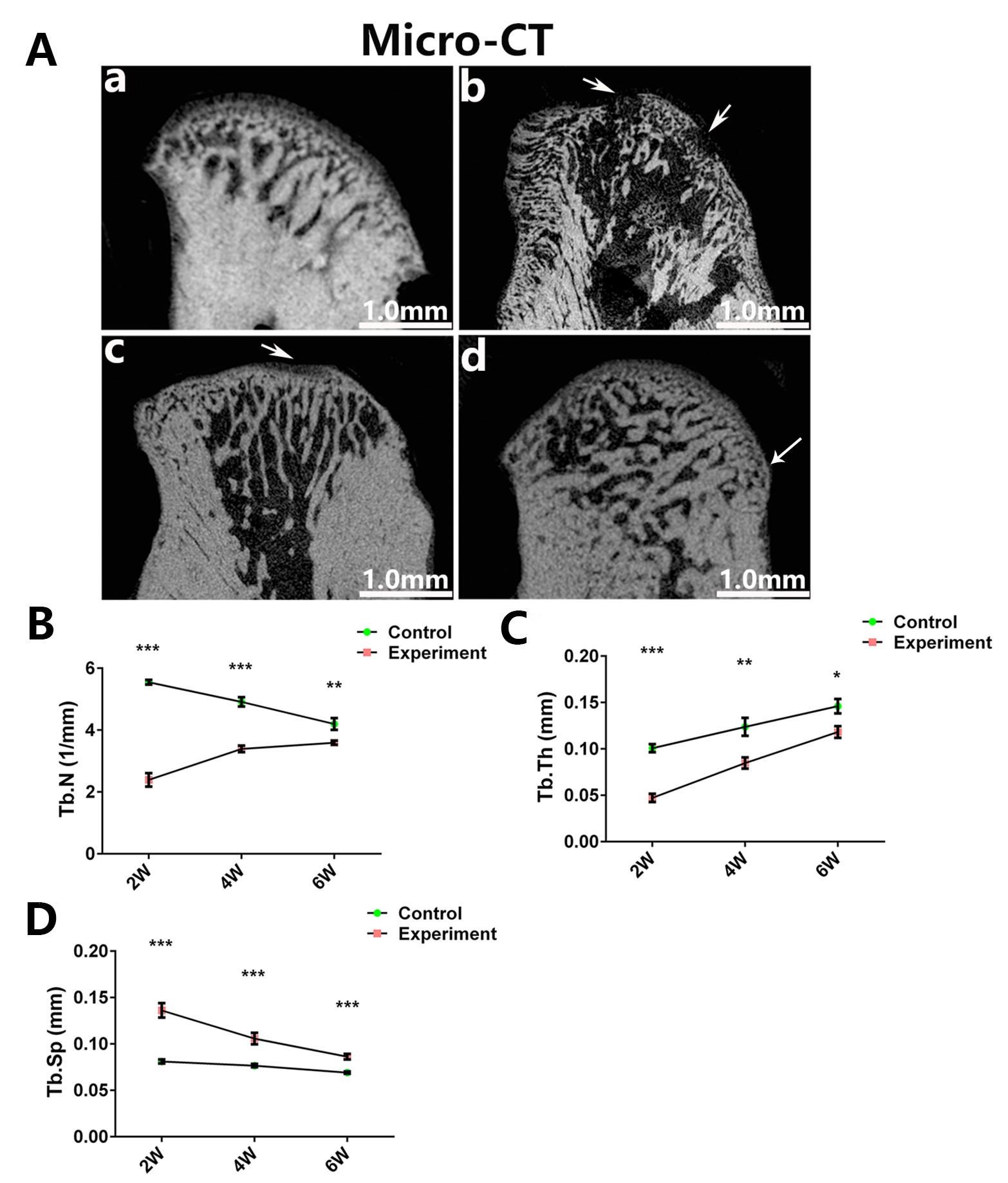 Bony changes in TMJ condyle. (A) In the control group (a), the 
subchondral bone was regularly aligned. Subchondral bone loss (arrows) were 
observed in the experimental groups ((b) 2 weeks MIA injection group, (c) 4 weeks 
MIA injection group). Osteophytes (arrows) were observed at 6 weeks MIA injection 
group (d). Lesion regions were larger at 2 weeks (b) than those at other time 
points (c, d). Scale bar = 1.0 mm in (A). Micro-CT analysis revealed that Tb.N 
(B) and Tb.Th (C) decreased, whereas Tb.Sp (D) increased at 2 weeks groups 
(*p < 0.05, **p < 0.01, 
***p < 0.001). Tb.N: trabecular number; Tb.Th: trabecular 
thickness; Tb.Sp: trabecular separation; CT: computed tomography.