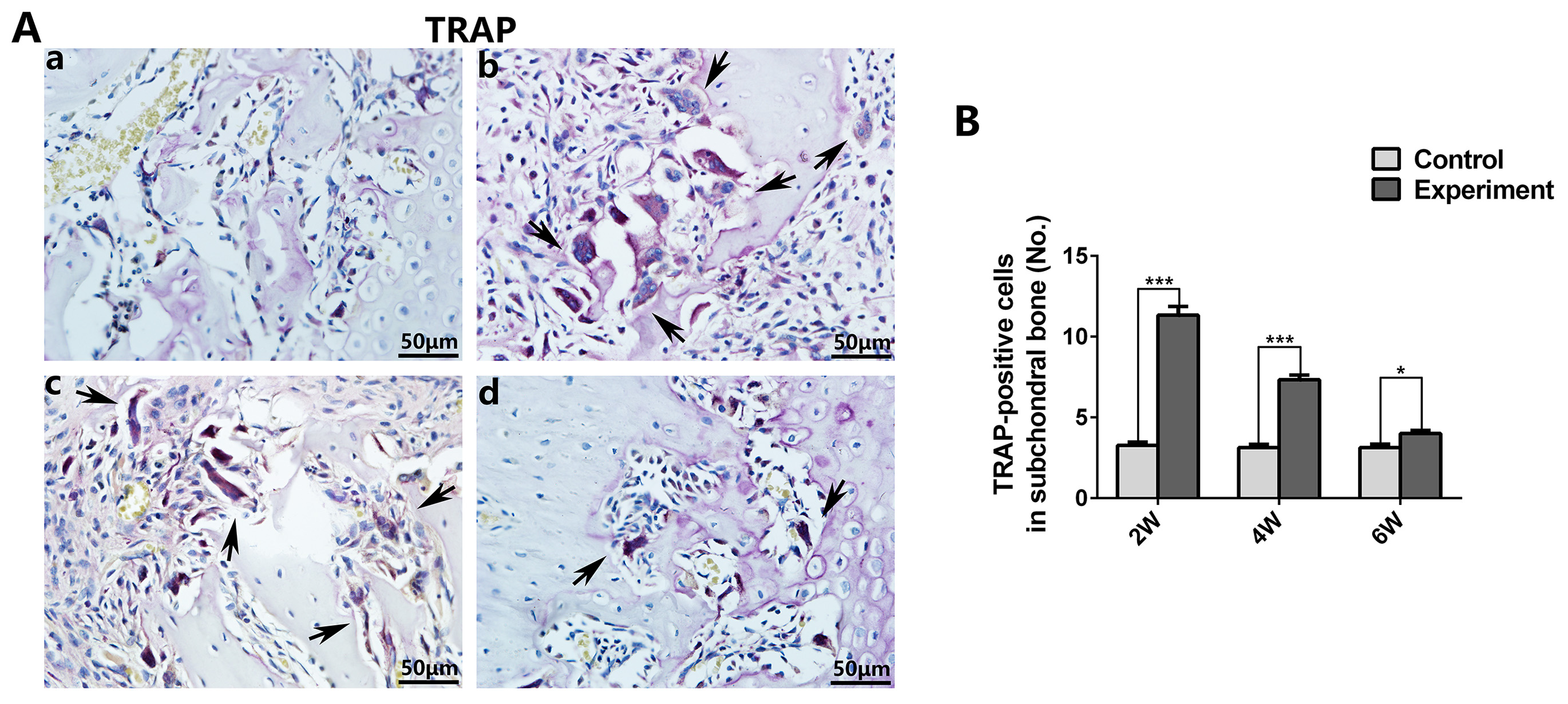 TRAP-positive cells in the TMJ subchondral bone. (A) In the 
control groups (a), TRAP staining showed that few osteoclast cells were observed 
in the subchondral bone. While, TRAP-positive cells in the subchondral bone were 
upregulated after MIA injection in the experimental groups, including 2, 4 and 6 
weeks ((b) 2 weeks MIA injection group, (c) 4 weeks MIA injection group, (d) 6 
weeks MIA injection group; scale bar = 50 μm in (A)). (B) In the 
experimental groups, TRAP-positive cells demonstrated a biphasic pattern, peaking 
at 2 weeks followed by gradual regression through 4- and 6-weeks groups 
(*p < 0.05, ***p < 0.001). TRAP: 
tartrate-resistant acid phosphatase.