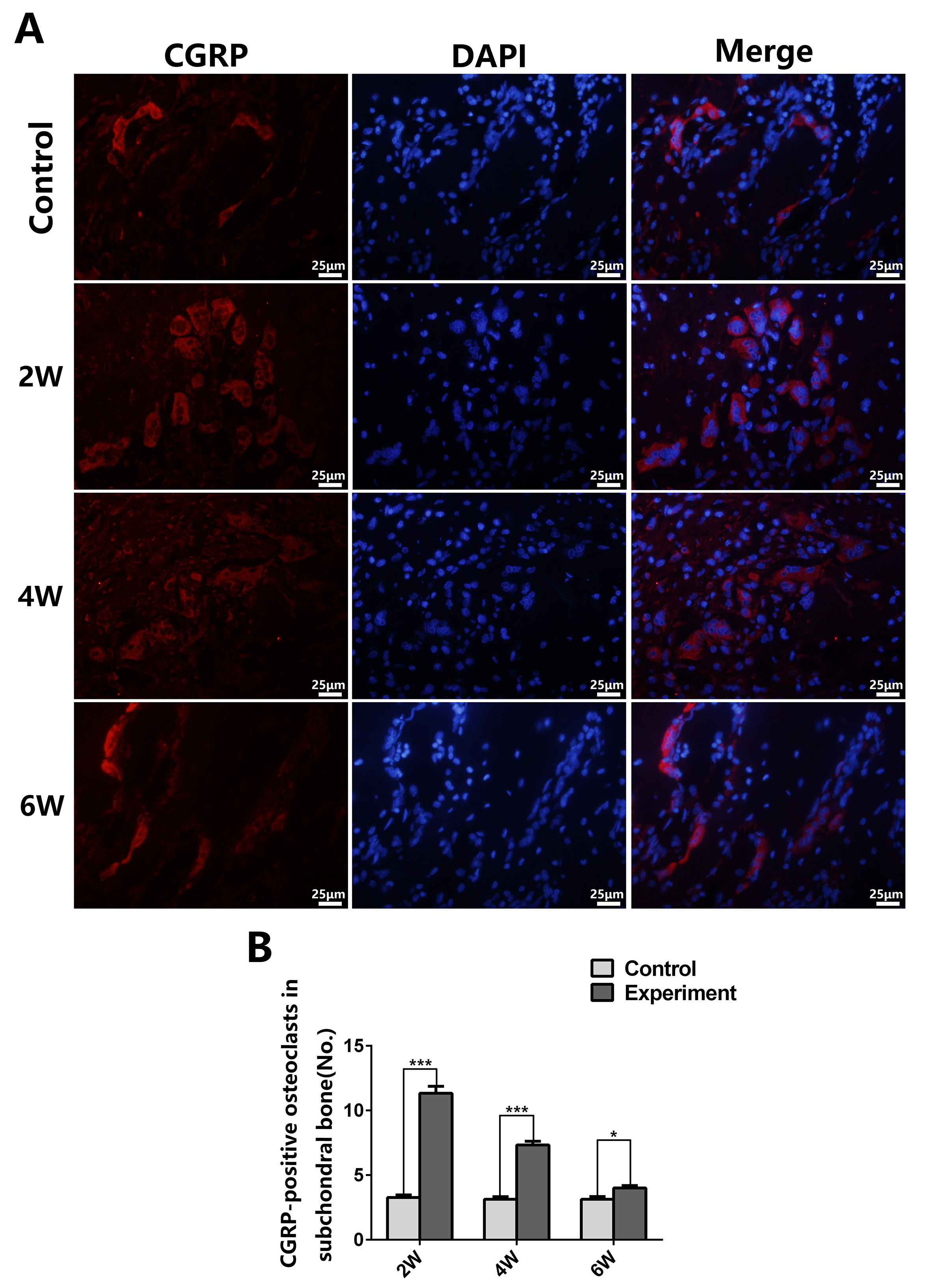 CGRP-positive osteoclasts in the TMJ subchondral bone. (A) CGRP 
was localized in the cytoplasm of osteoclasts. In the control groups, 
immunofluorescence staining showed that few CGRP-positive osteoclasts were 
observed in the subchondral bone. While CGRP-positive osteoclasts were obviously 
observed after MIA injection in the experimental groups, including 2, 4 and 6 
weeks. Scale bar = 25 μm in (A). (B) In the experimental groups, 
CGRP-positive osteoclasts demonstrated a biphasic pattern, peaking at 2 weeks 
followed by gradual regression through 4- and 6-weeks groups 
(*p < 0.05, ***p < 0.001). CGRP: 
calcitonin gene related peptide; DAPI: 4′-6-diamidino-2-phenyl-indole.