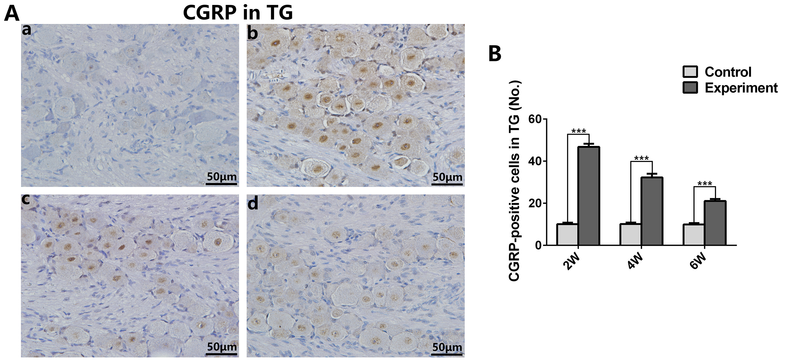 CGRP expression in the TG. (A) In the control groups (a), 
immunohistochemical staining showed that few CGRP-positive cells were observed in 
the TG. While CGRP-positive cells were obviously observed after MIA injection in 
the experimental groups, including 2, 4 and 6 weeks ((b) 2 weeks MIA injection 
group, (c) 4 weeks MIA injection group, (d) 6 weeks MIA injection group; scale 
bar = 50 μm in (A)). (B) In the experimental groups, CGRP-positive cells in 
the TG demonstrated a biphasic pattern, peaking at 2 weeks followed by gradual 
regression through 4- and 6-weeks groups (***p < 0.001). TG: 
trigeminal ganglion; CGRP: calcitonin gene related peptide.