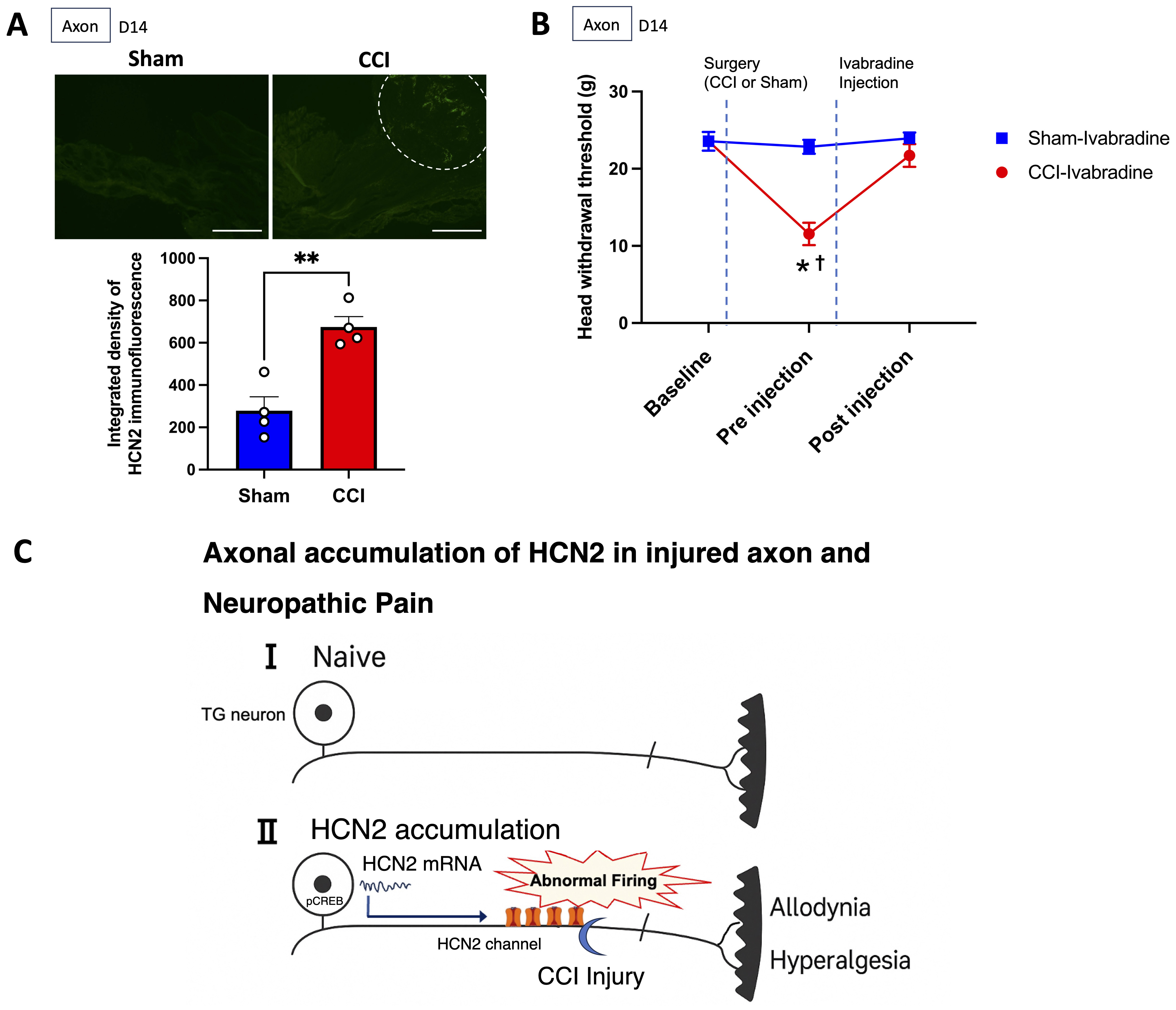 ION-CCI increased HCN2 channel expression in injured axon and 
blocking peripheral HCN channels by ivabradine reversed ION-CCI-induced 
mechanical hyperalgesia. (A) The integrated density of HCN2 immunofluorescence 
in axons was significantly higher in the CCI group compared with the sham group 
(**p = 0.003, unpaired t-test; n = 4 per group). Scale bar = 
500 µm. The area outlined by the dotted line indicates the region of 
HCN2-positive accumulation in the axon (proximal to the constriction site). (B) 
Among the groups, a significant difference in head withdrawal threshold was 
observed between the CCI-Ivabradine and Sham-Ivabradine groups after surgery at 
pre-injection time point, meaning that CCI decreased the thresholds (*p 
< 0.001, repeated measurement two-way ANOVA followed by Šídák’s 
multiple comparisons test). Within the CCI-Ivabradine group, a significant 
difference in head withdrawal threshold was observed between pre-injection and 
post-injection of ivabradine, meaning that ivabradine reversed the thresholds 
(†p  < 0.001, repeated measurement two-way ANOVA 
followed by Tukey’s multiple comparisons test). Within the Sham-Ivabradine group, 
no significant difference in the threshold was observed between pre-injection and 
post-injection of ivabradine (p = 0.880, repeated measurement two-way 
ANOVA followed by Tukey’s multiple comparisons test). CCI-Ivabradine (n = 6), 
Sham-Ivabradine (n = 4), respectively. (C) A schema of axonal accumulation of 
HCN2 channel in the injured axon. CCI, Chronic Constriction Injury; HCN, 
Hyperpolarization-activated cyclic nucleotide-gated; TG, trigeminal ganglion; 
pCREB, phosphorylated cAMP response element-binding protein.