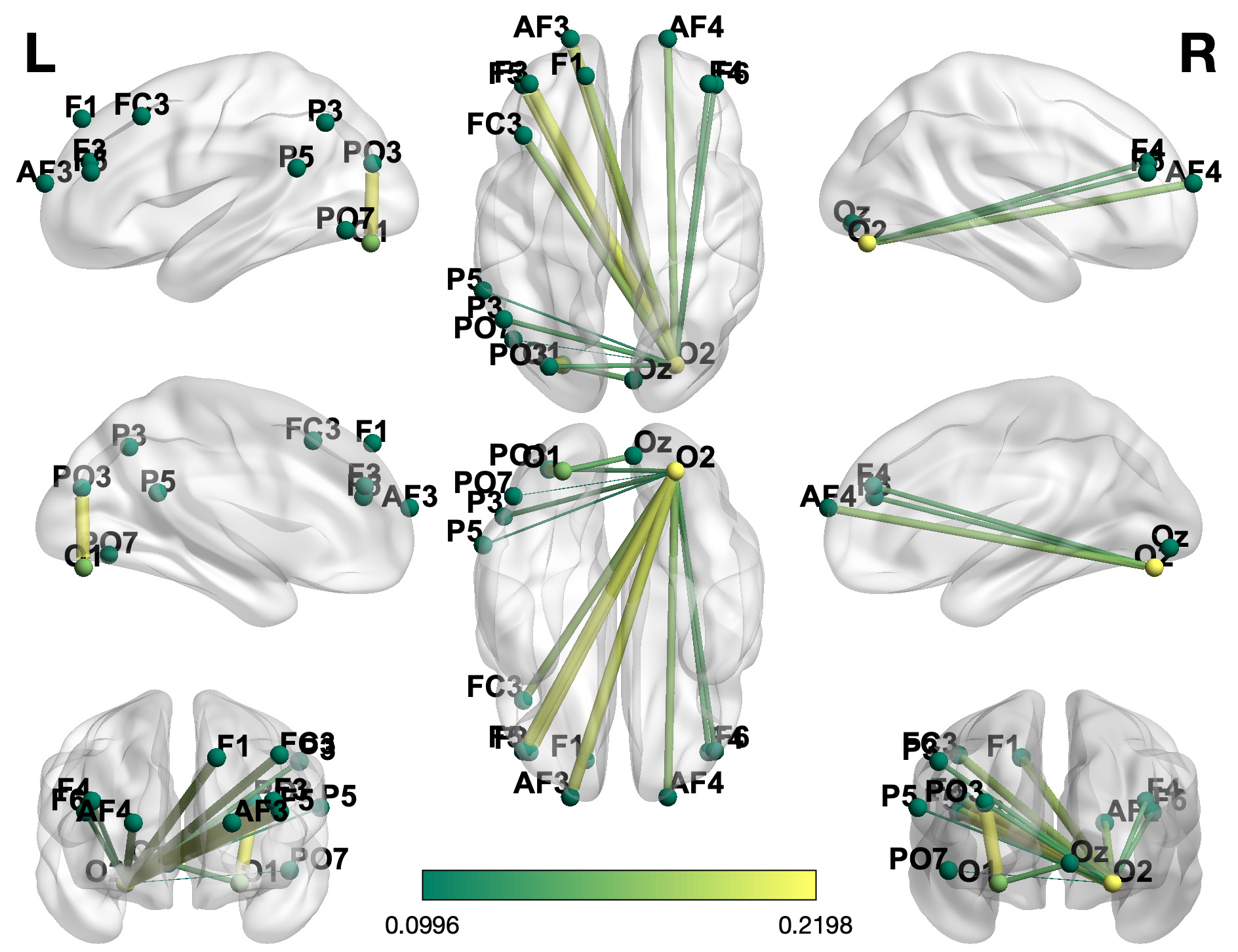 Results of phase synchronization. Brain functional connectivity
maps based on the O2 and O1 channels showing significant alterations in
migraineurs. Following FDR correction, Mann-Whitney U tests showed that
migraineurs demonstrated higher alpha-band phase synchronization between O2 and
frontal regions (F1/F3/F4/F5/F6/AF3/AF4/FC3; pFDR = 0.007–0.043),
as well as between O2 and parietal regions (P3/P5/PO3/PO7; pFDR =
0.003–0.021), relative to healthy controls. Migraineurs also showed
significantly higher alpha-band phase synchronization between the left occipital
cortex (O1) and parieto-occipital cortex (PO3)/occipital zero cortex (Oz)
(pFDR = 0.003–0.040). Connectivity strength is reflected by line
thickness (0.0996–0.2198).