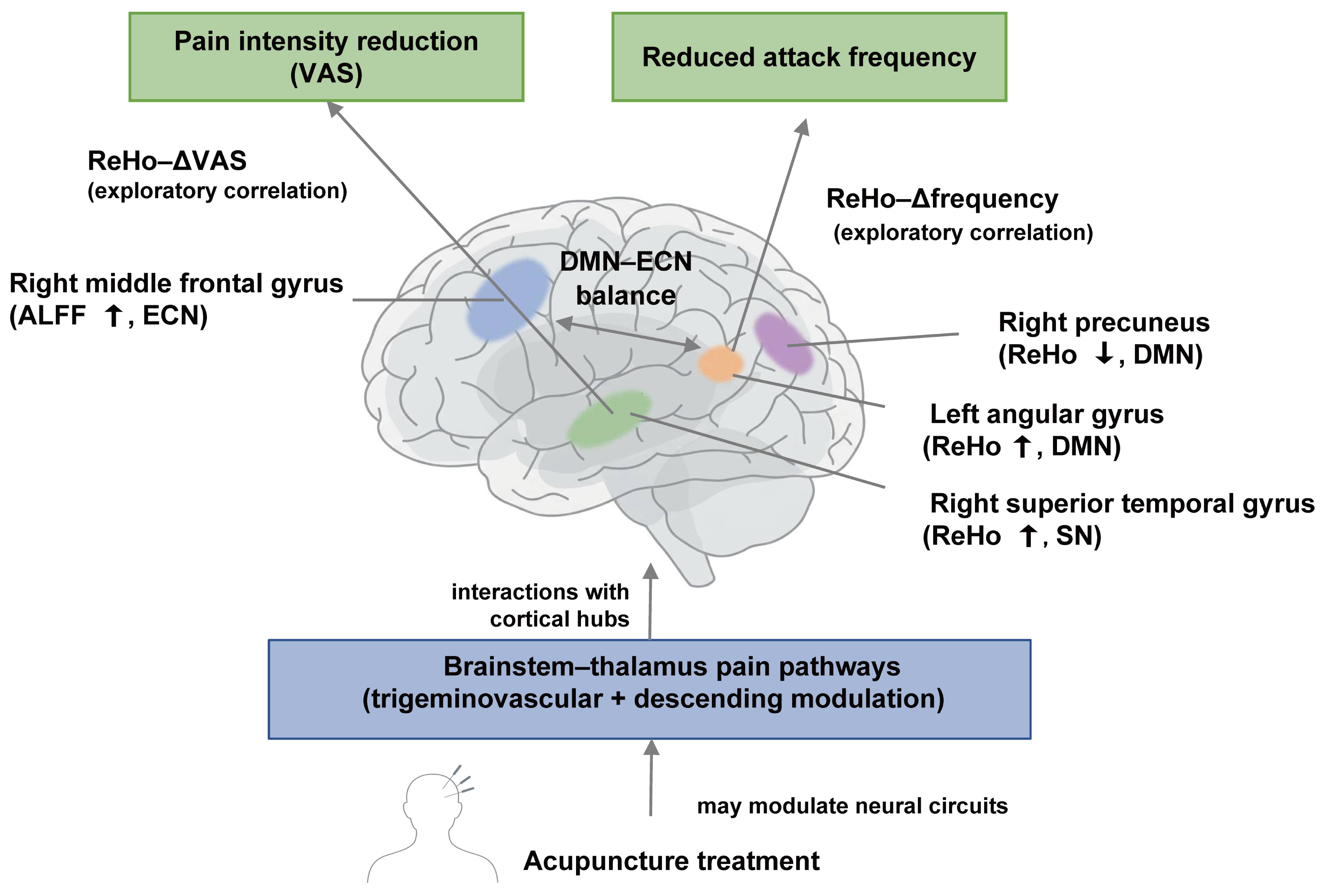 Proposed neural correlates of acupuncture in migraine. Upward
arrows (↑) indicate increased ALFF/ReHo values after acupuncture,
whereas downward arrows (↓) indicate decreased ALFF/ReHo values.
DMN, default mode network; ECN, executive control network; SN, salience network;
ReHo, regional homogeneity; ALFF, amplitude of low-frequency fluctuation; VAS,
Visual Analogue Scale.
